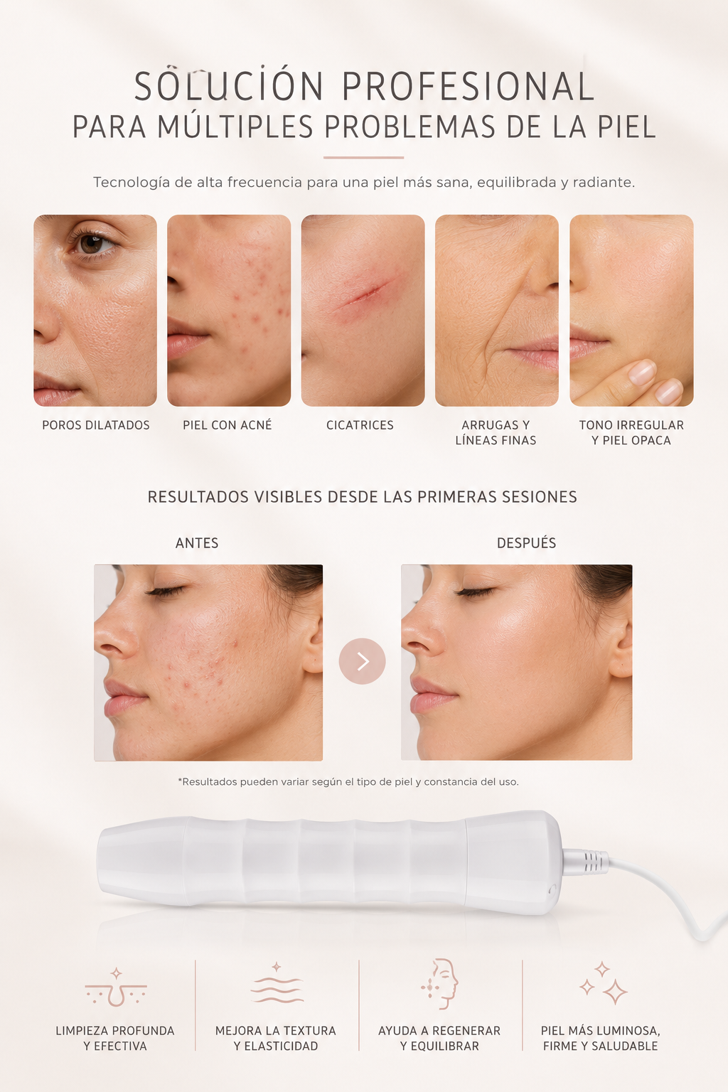 TaraSkin™ High-Frequency Facial